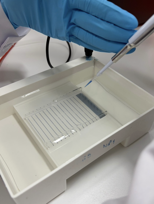 Gel Electrophoresis